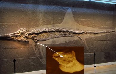 Місце стовбурових клітин у лікуванні остеонекрозу різної локалізації. Остеонекроз (аваскулярний некроз; асептичний некроз; ішемічний некроз кісткової тканини)