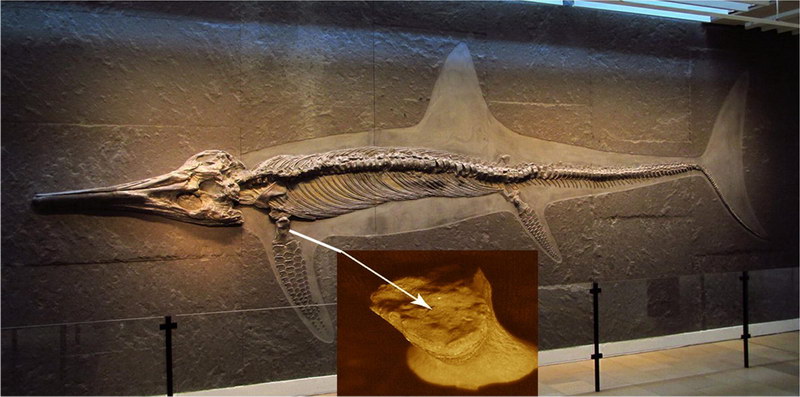 Місце стовбурових клітин у лікуванні остеонекрозу різної локалізації. Остеонекроз (аваскулярний некроз; асептичний некроз; ішемічний некроз кісткової тканини)