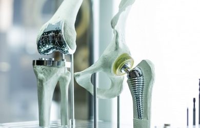 ндопротезування суглобів в ДУ «Інститут травматології та ортопедії НАМНУ» м. Київ