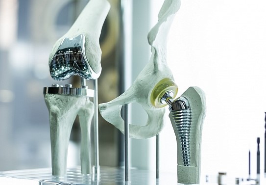 ндопротезування суглобів в ДУ «Інститут травматології та ортопедії НАМНУ» м. Київ
