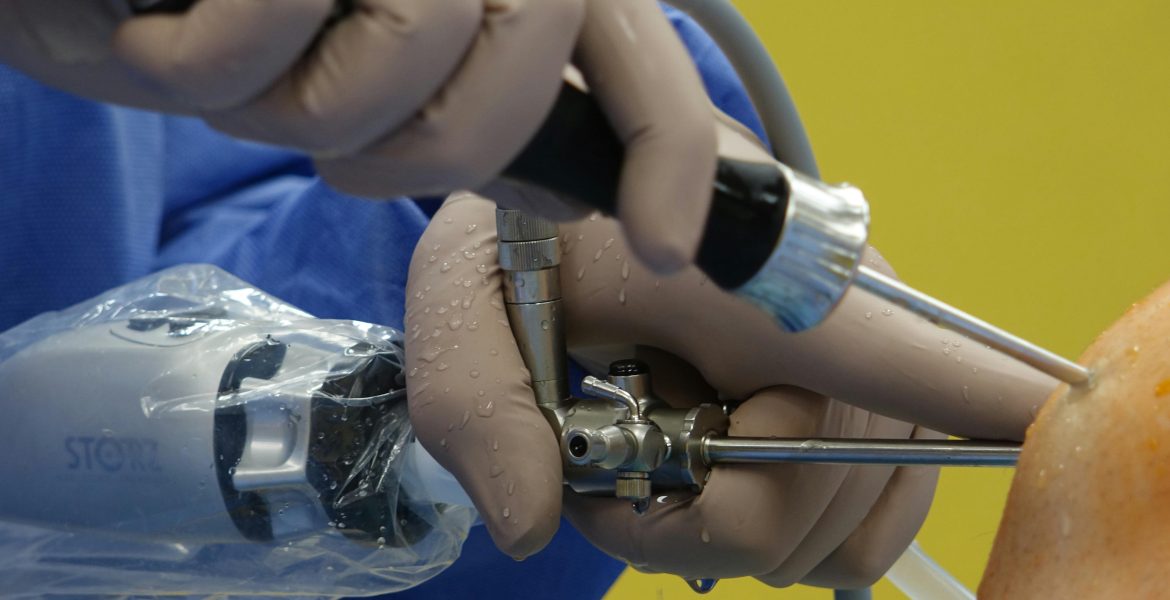 Detailed view of a surgeon performing arthroscopic knee surgery using specialized equipment.