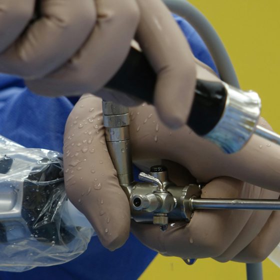 Detailed view of a surgeon performing arthroscopic knee surgery using specialized equipment.