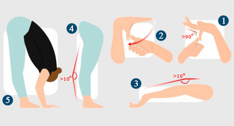 Синдром гіпермобільності суглобів — це стан, при якому визначається перевищення обсягу рухів в одному або декількох суглобах порівняно з нормальними середньостатистичними показниками, що пов’язане з особливістю сполучно-тканинного білка — колагену. Дана особливість має назву системної дисплазії сполучної тканини.