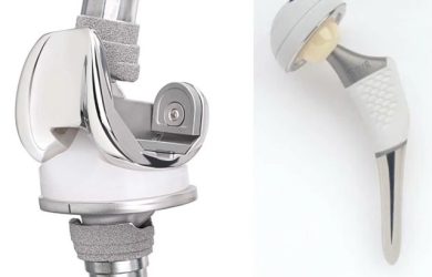 Ендопротезування великих суглобів. Історія