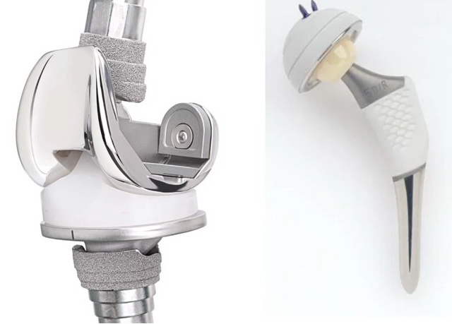 Ендопротезування великих суглобів. Історія